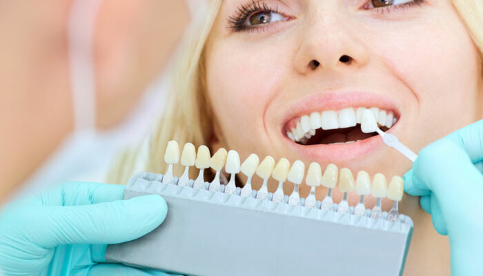 Dental Implants – Procedure and Cost