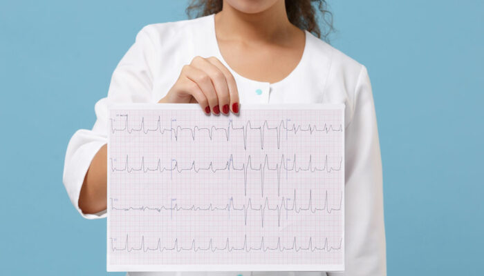 Echocardiogram – Purpose, Preparation, and Procedure