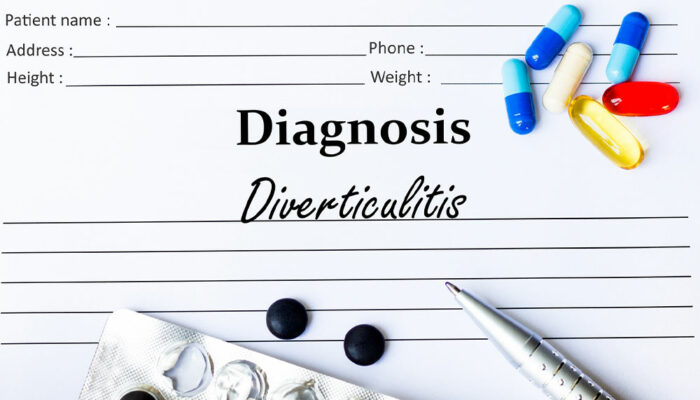 Diverticulitis – Causes, Symptoms, and How to Manage the Condition