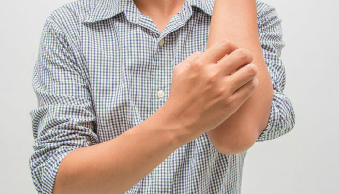 Jock Itch Disease – Its Symptoms, Causes, and Diagnoses