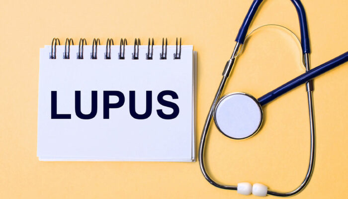Lupus – Signs, Causes and Types