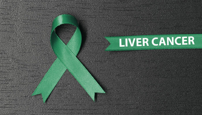 Liver Cancer – Causes, Symptoms, and Therapies