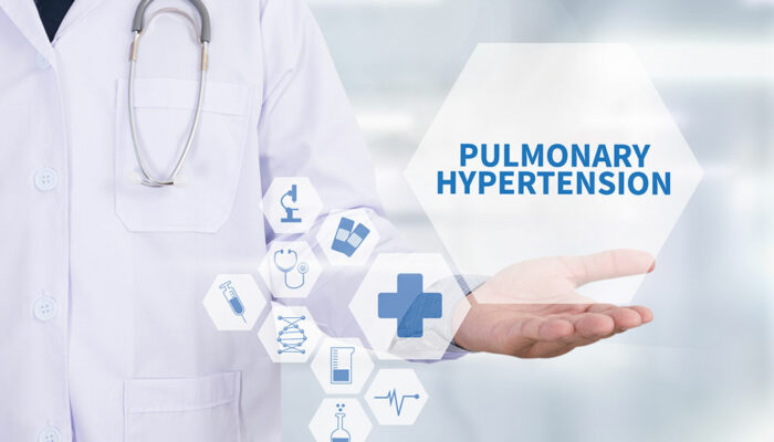 Pulmonary arterial hypertension – Causes, symptoms, and preventive measures