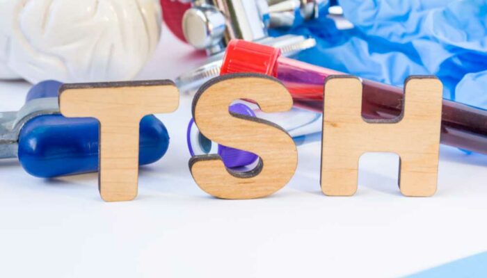 Understanding TSH Levels – How to Keep Them under Normal Range