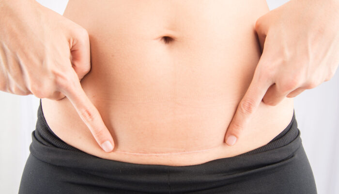 5 Truths About Post Baby Bodies