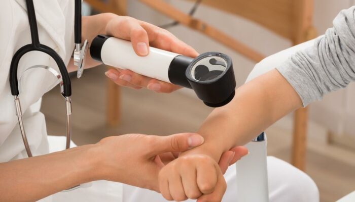 All you need to know about baby eczema