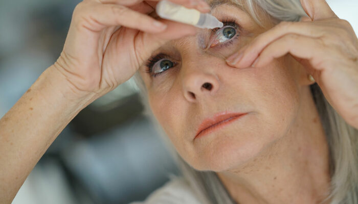 Dry Eyes – Symptoms, Causes, and Treatment Options