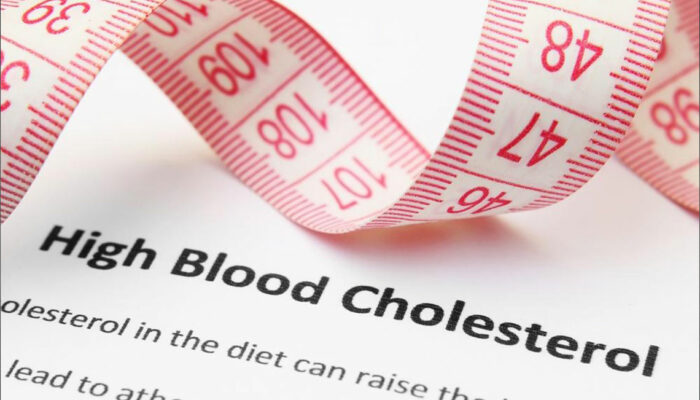 Easy Steps for Cholesterol Level Diagnosis