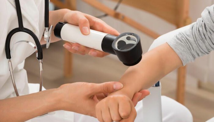 Eczema – Symptoms, Complications, and Treatment Options