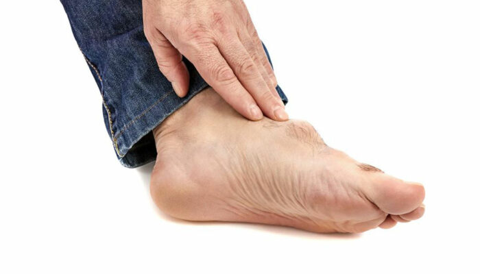 Gout – Causes, Symptoms, Treatment, and Diet Plans