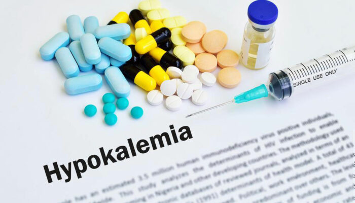 Hypokalemia – what you should know
