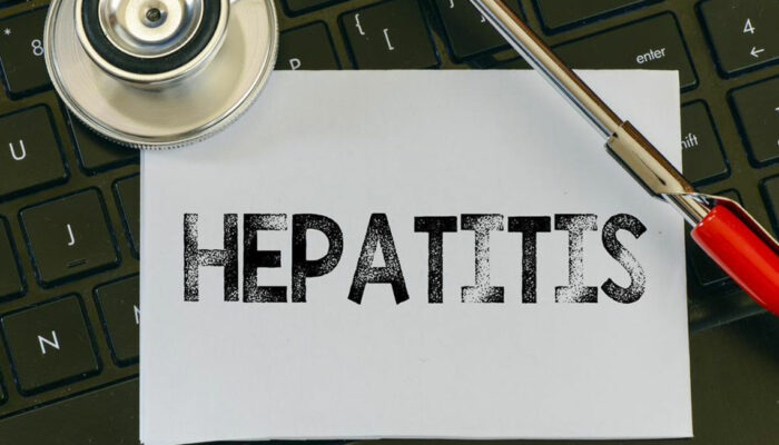 Hepatitis C – Causes, Symptoms, and Treatment