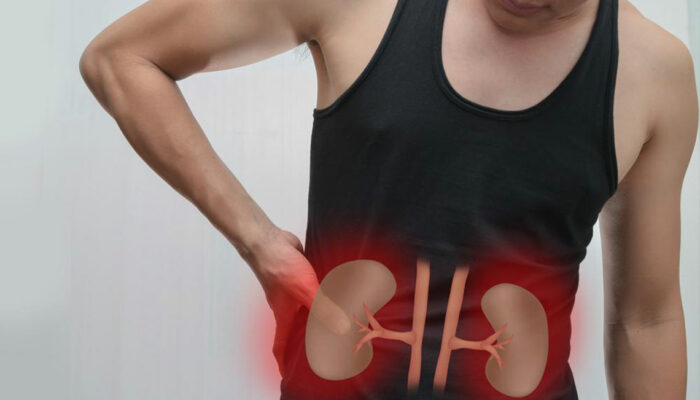 Kidney Failure – Causes and Symptoms