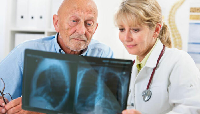 Pneumonia – Prognosis and Treatment Options