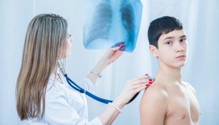 Pneumococcal Pneumonia – Symptoms, Treatment, and More