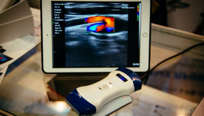 Portable ultrasound machines – Types and top choices