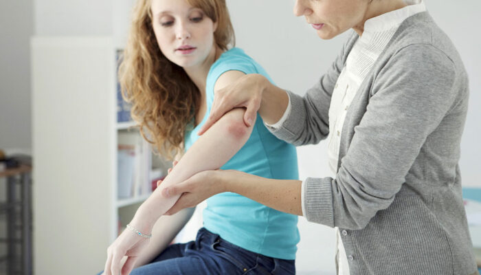 Psoriasis – symptoms, causes, and treatment options