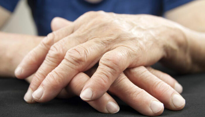Rheumatoid Arthritis – Symptoms, Causes, and Remedies