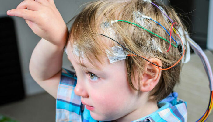 Seizures – Symptoms and Treatment