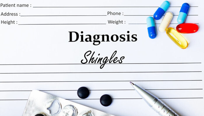 Shingles – Symptoms, Risk Factors, and Treatments